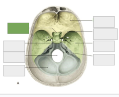 <p>Cranial fossa: this is</p>