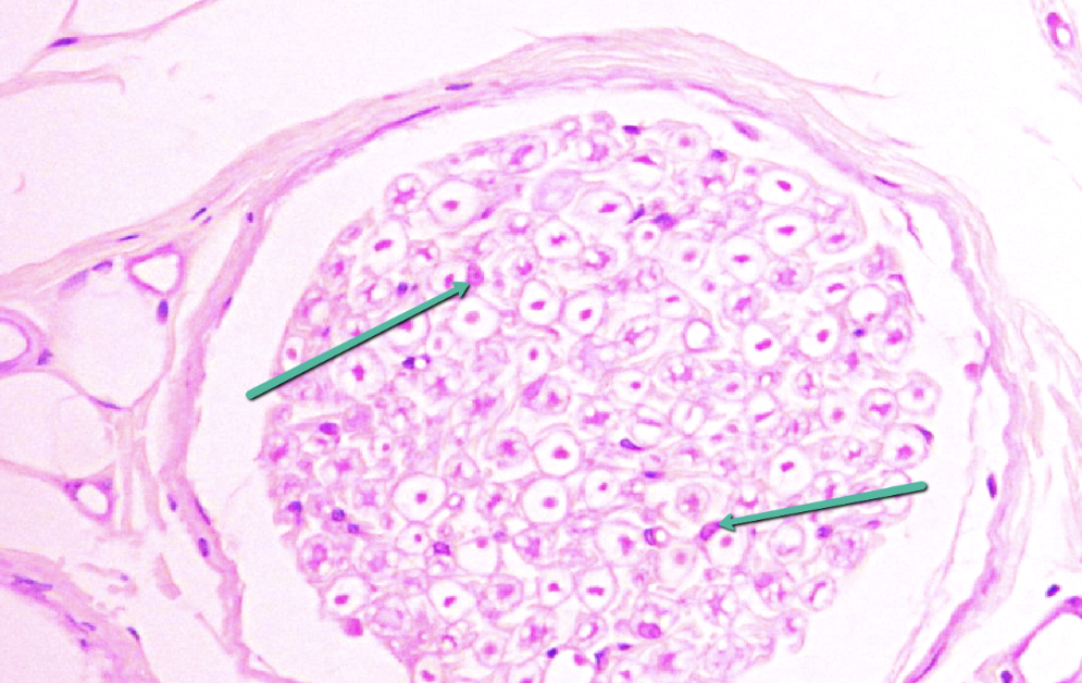 <p><span>Identify the small oval spots next to the white areas indicated by the pointers.</span></p>