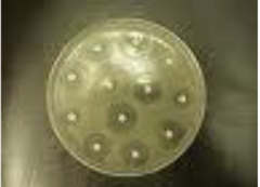 <p>What is the zone of inhibition?</p>