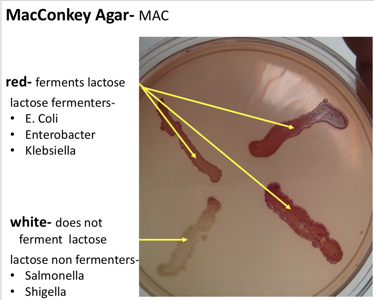 <p>MacConkey agar (MAC)- differential?</p>