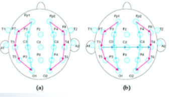 <p>Each EEG “channel” is the difference between two electrode recordings, such as F7-T3</p>