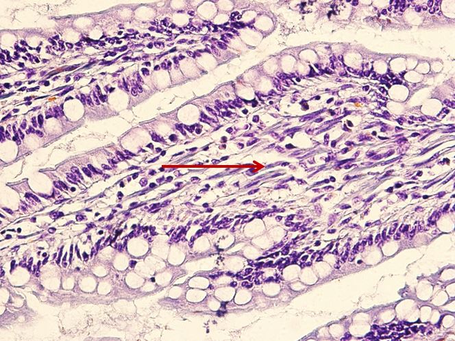 <p>Tế bào gì ?</p>