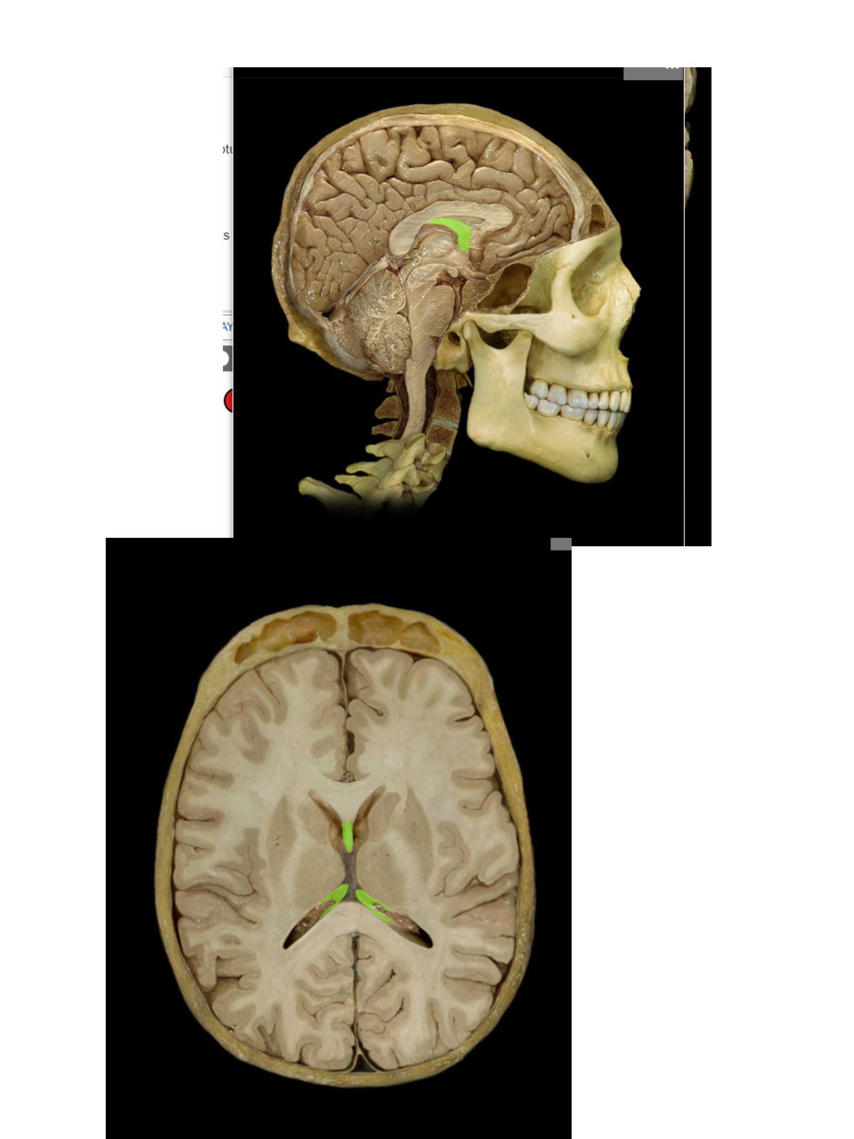 <p><span>Fornix of brain</span></p>