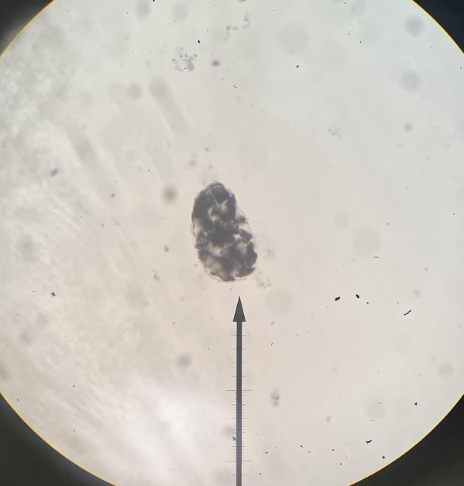 <p><span>what illness does this organism cause for thousands of humans without access to clean drinking water?</span></p>