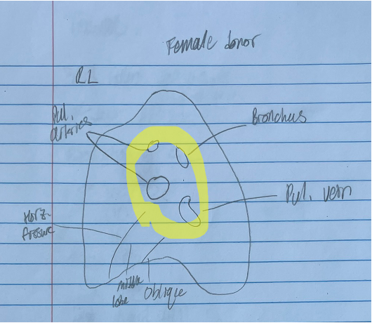 <p>id and func. + which lung</p>