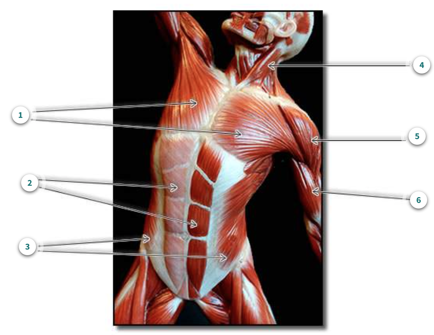 <p>What part of the body are these muscles?</p>