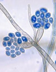 <p>Chitin.</p>