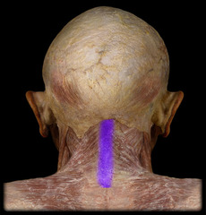 <p>Name the ligament</p>