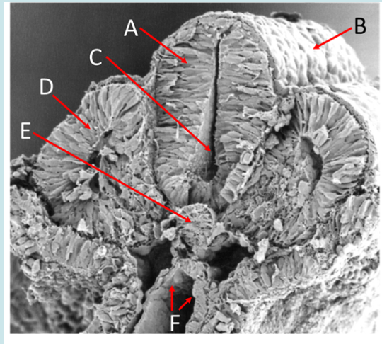 <ol><li><p>Label A, B, C, D and E</p></li><li><p>Name the part of the primitive streak that gives rise to E</p></li><li><p>Name the primary germ layer the cells lining tube F are derived from</p></li><li><p>At this stage, tube F opens into the</p></li><li><p>What view is this?</p></li></ol><p></p>
