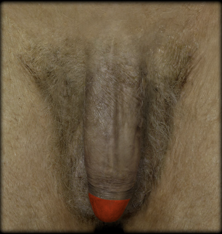 term image