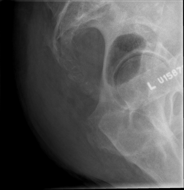 <p>critique this coccyx lateral</p>