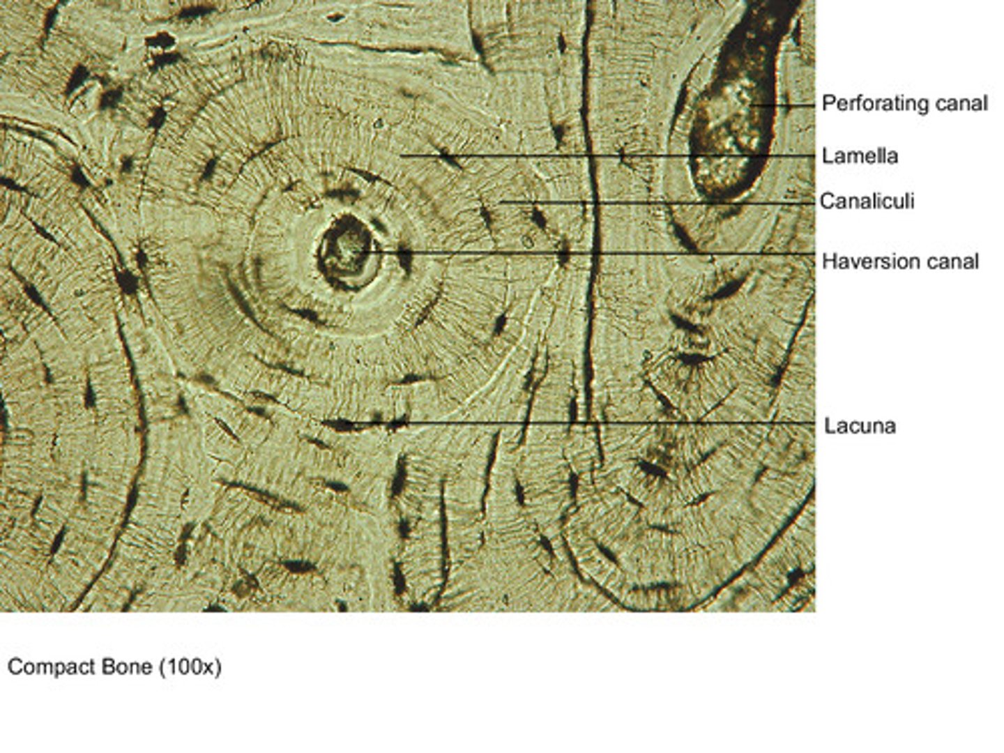 <p>Concentric rings (osteons) and dark spots (osteocytes), spongy bone</p>