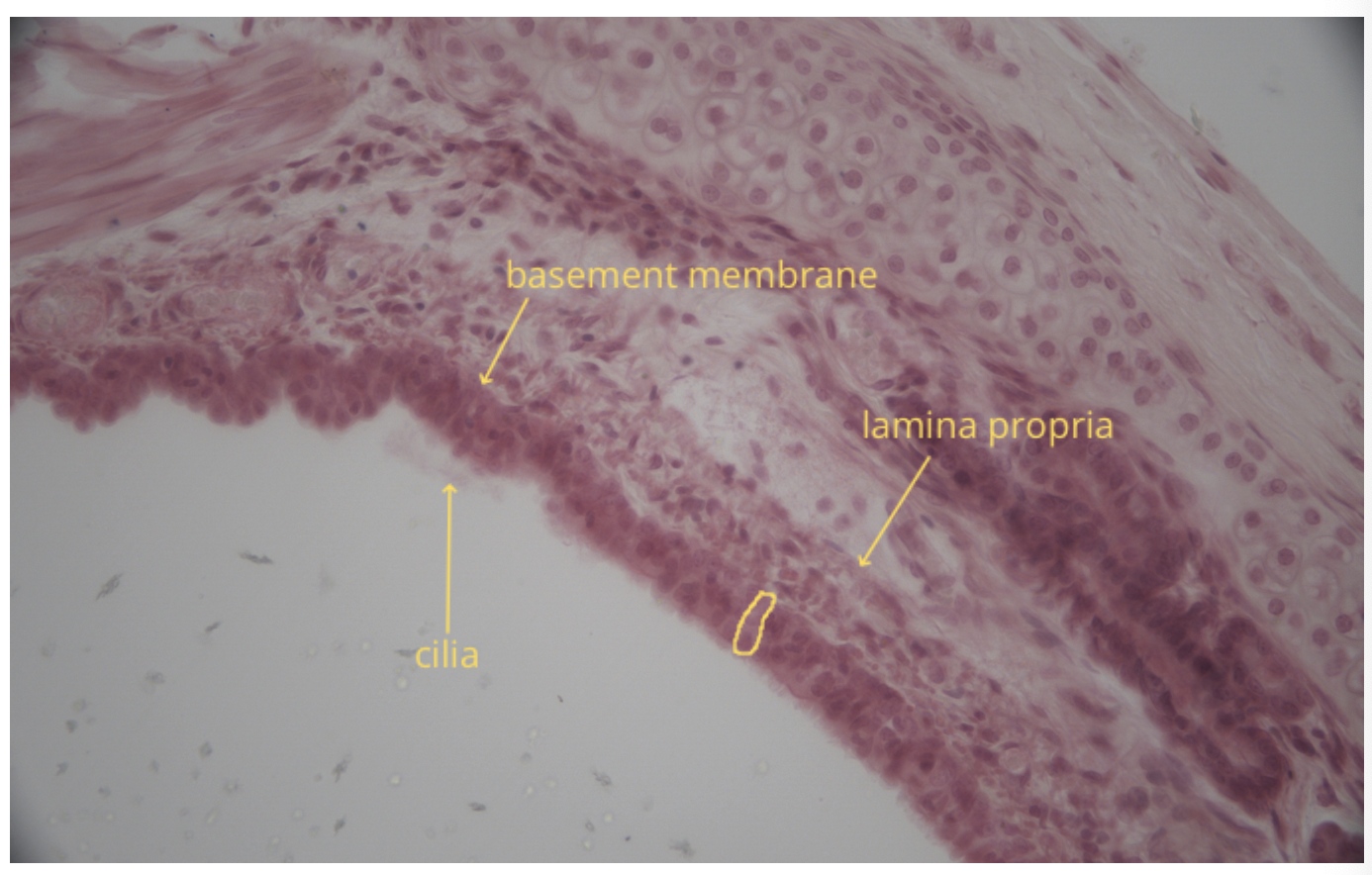 term image