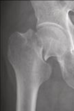 <p>localizacion?</p>