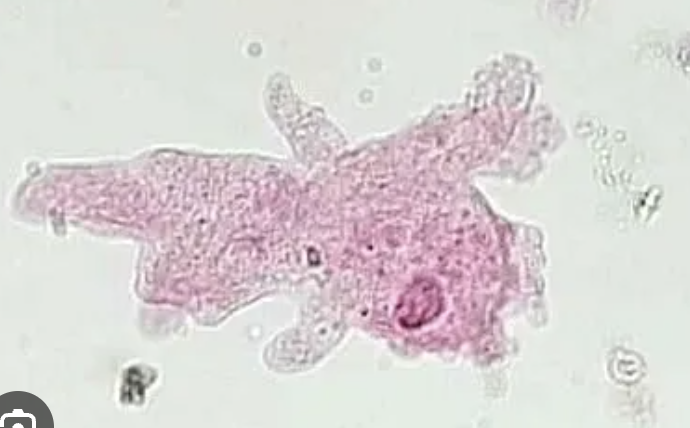 term image