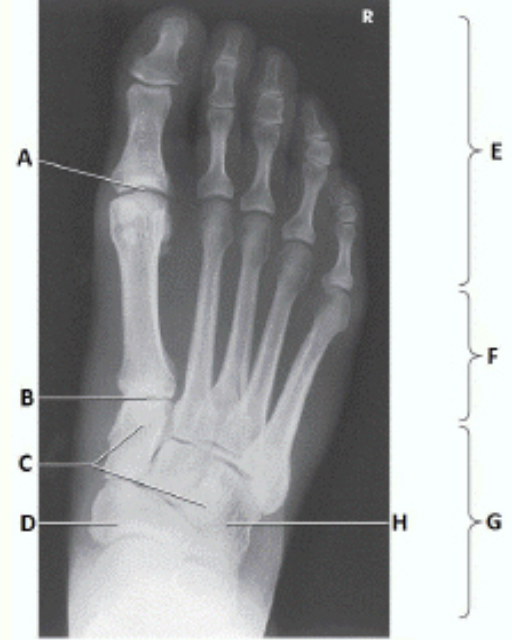 <p>Label this image.</p>