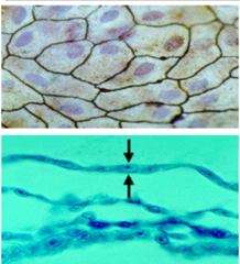 <p>single layer of flattened cells</p>