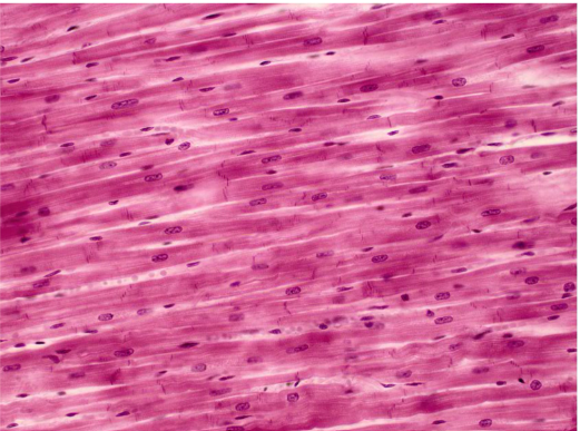 <p>What kind of muscle is this</p>