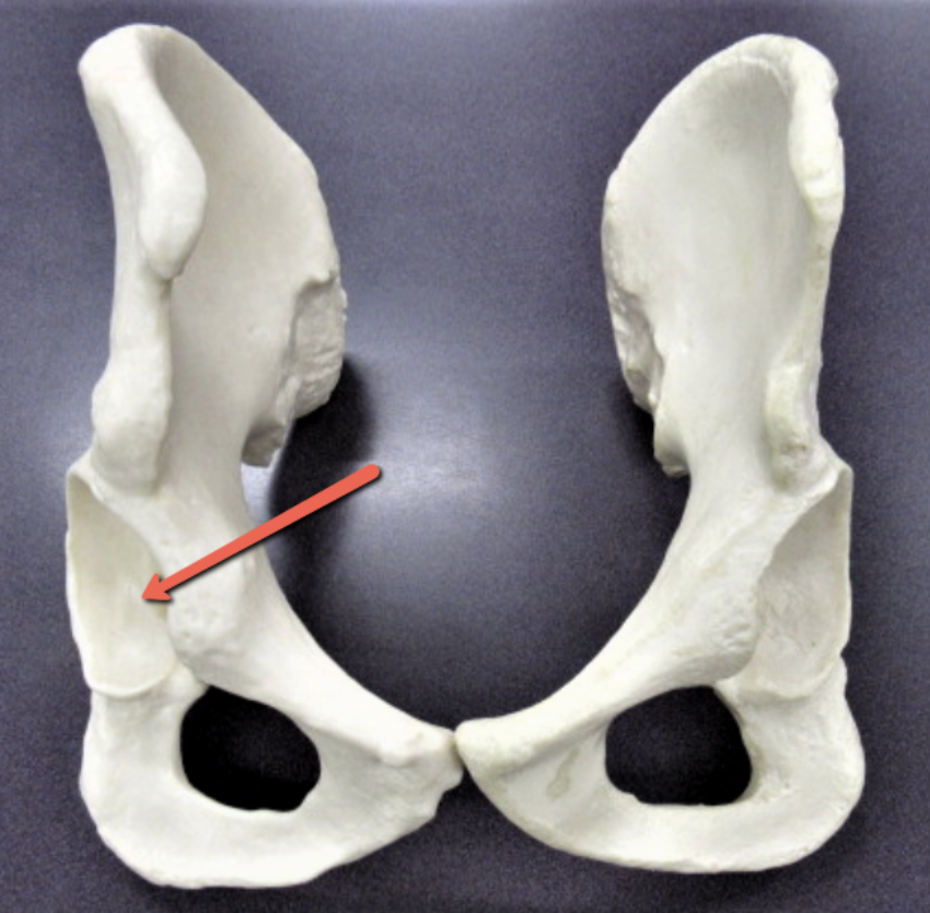 <p><strong>Identify the bone marking indicated by the pointer.</strong></p>