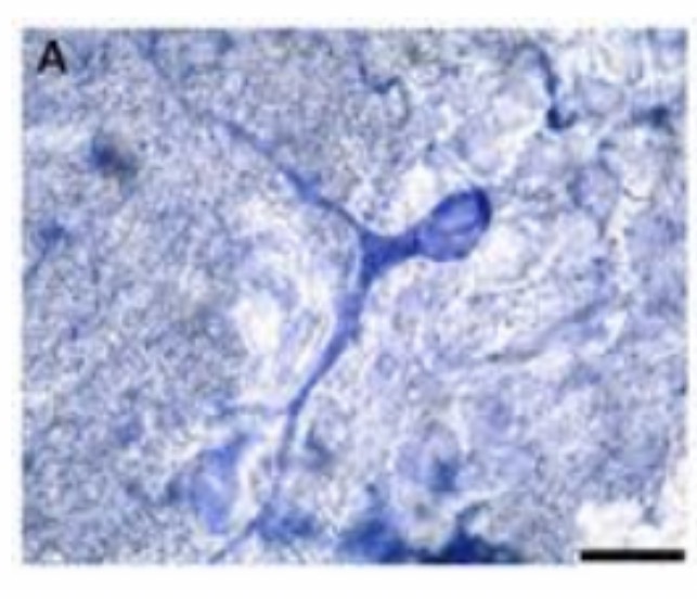 <p>Unipolar : Function : Carries sensory impulses from receptors to the central nervous system.</p>