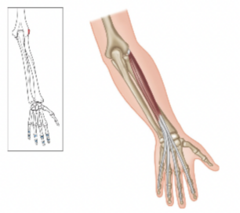 <p>What muscle is shown?</p>