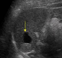 <p>Identify this image. </p>