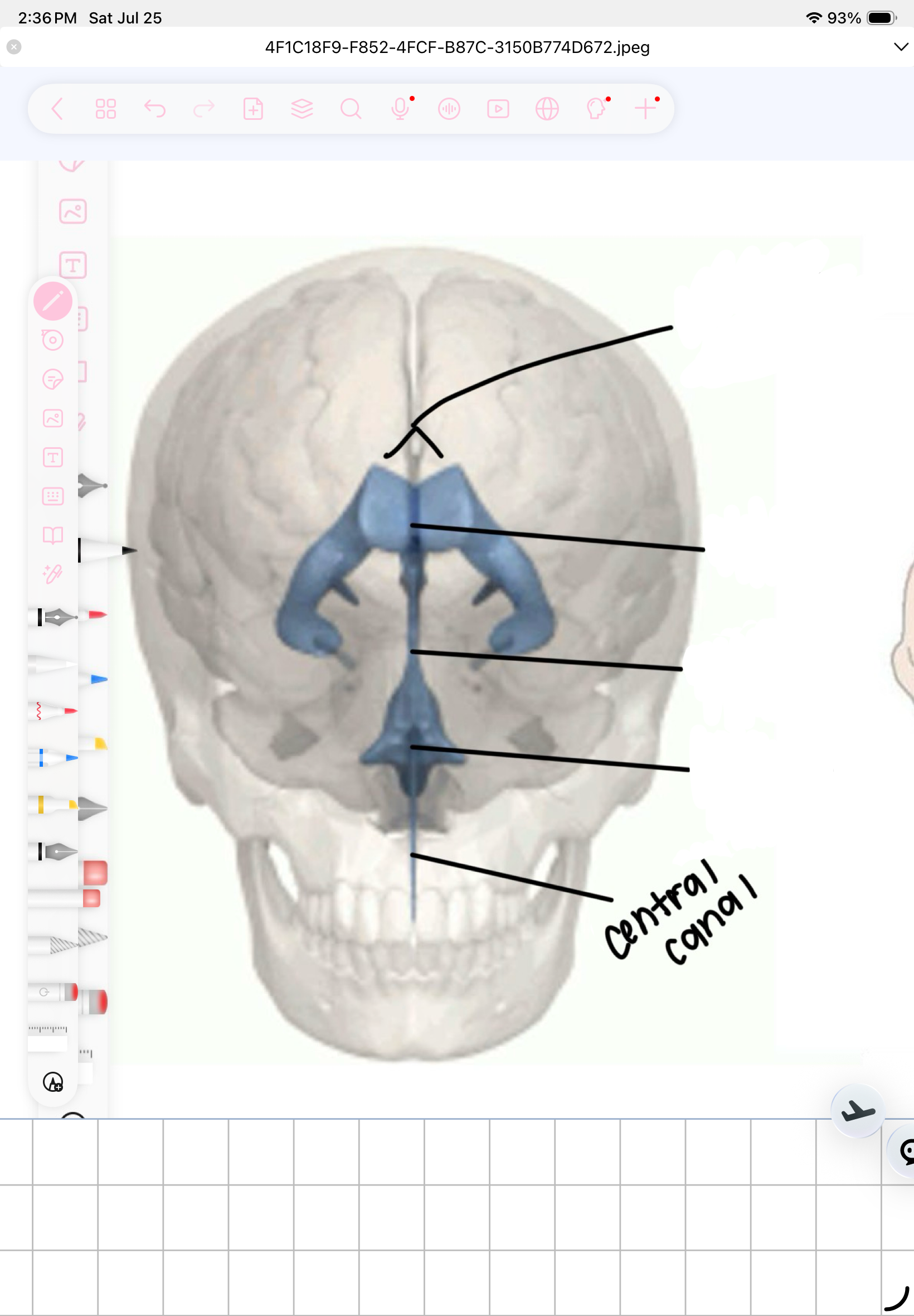 term image