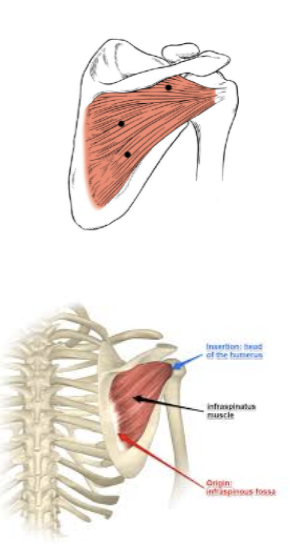 <p>What muscle is this? </p>