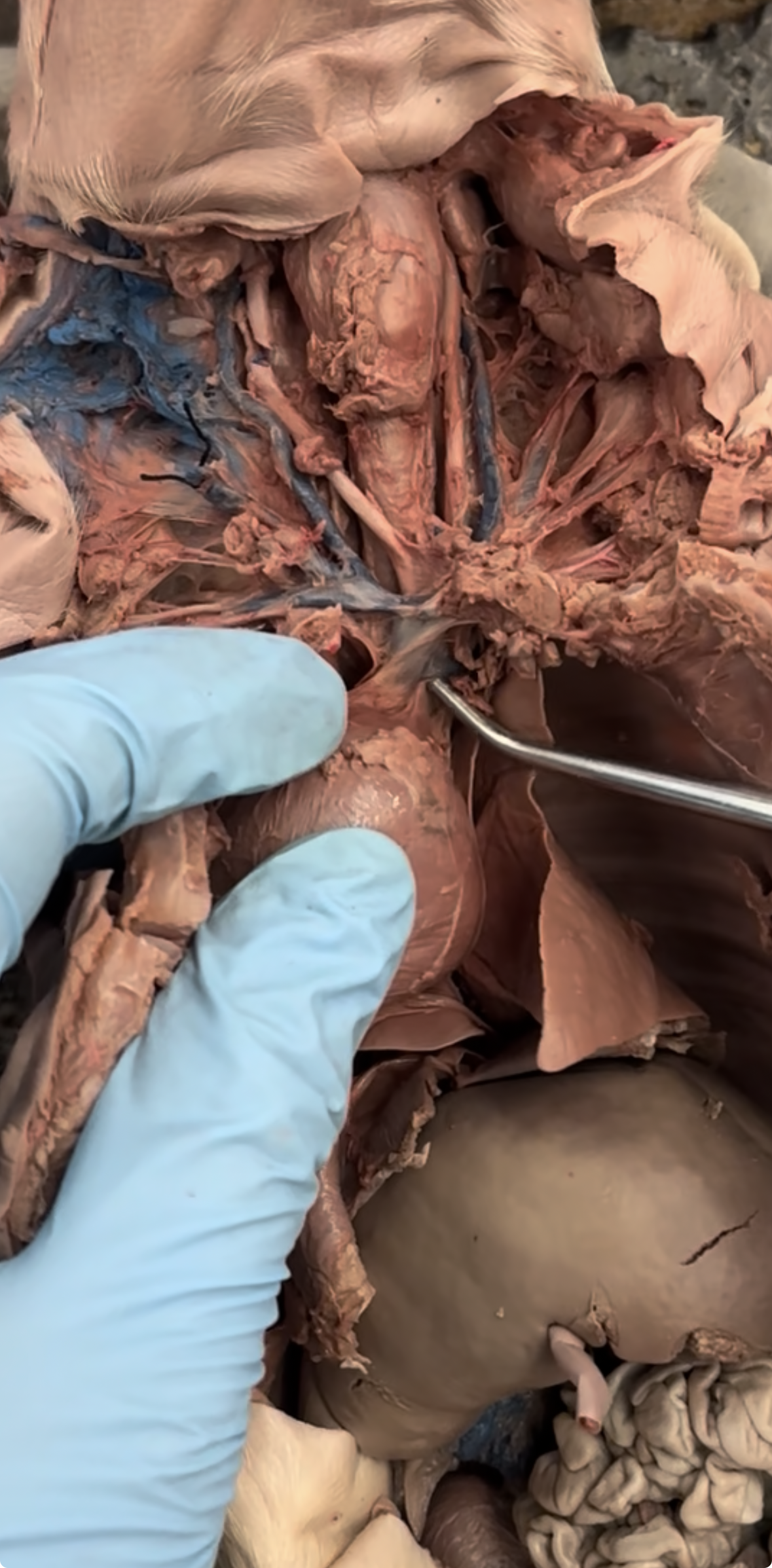 <p>serves neck &amp; upper ribs</p>