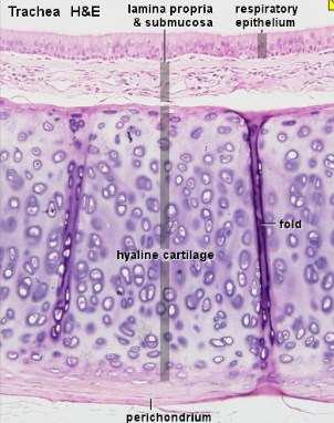 <p>What type of cartilage is this?</p>