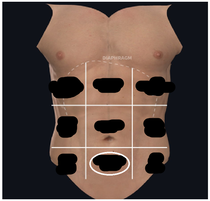 <ul><li><p><span style="background-color: transparent;">Inferior to umbilical</span></p></li><li><p><span style="background-color: transparent;">Below navel</span></p></li></ul><p></p>