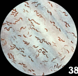 <p>Comma Shaped </p>