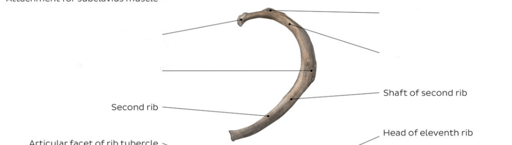 <p>Fill in the missing labels for the ___ rib</p>