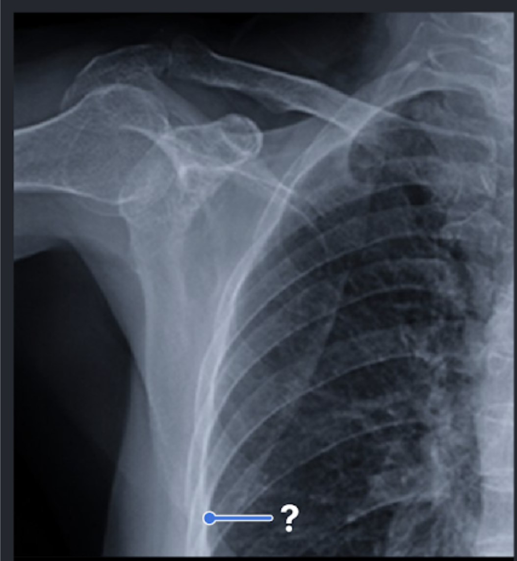 <p>Indenitfy pointed anatomy </p>