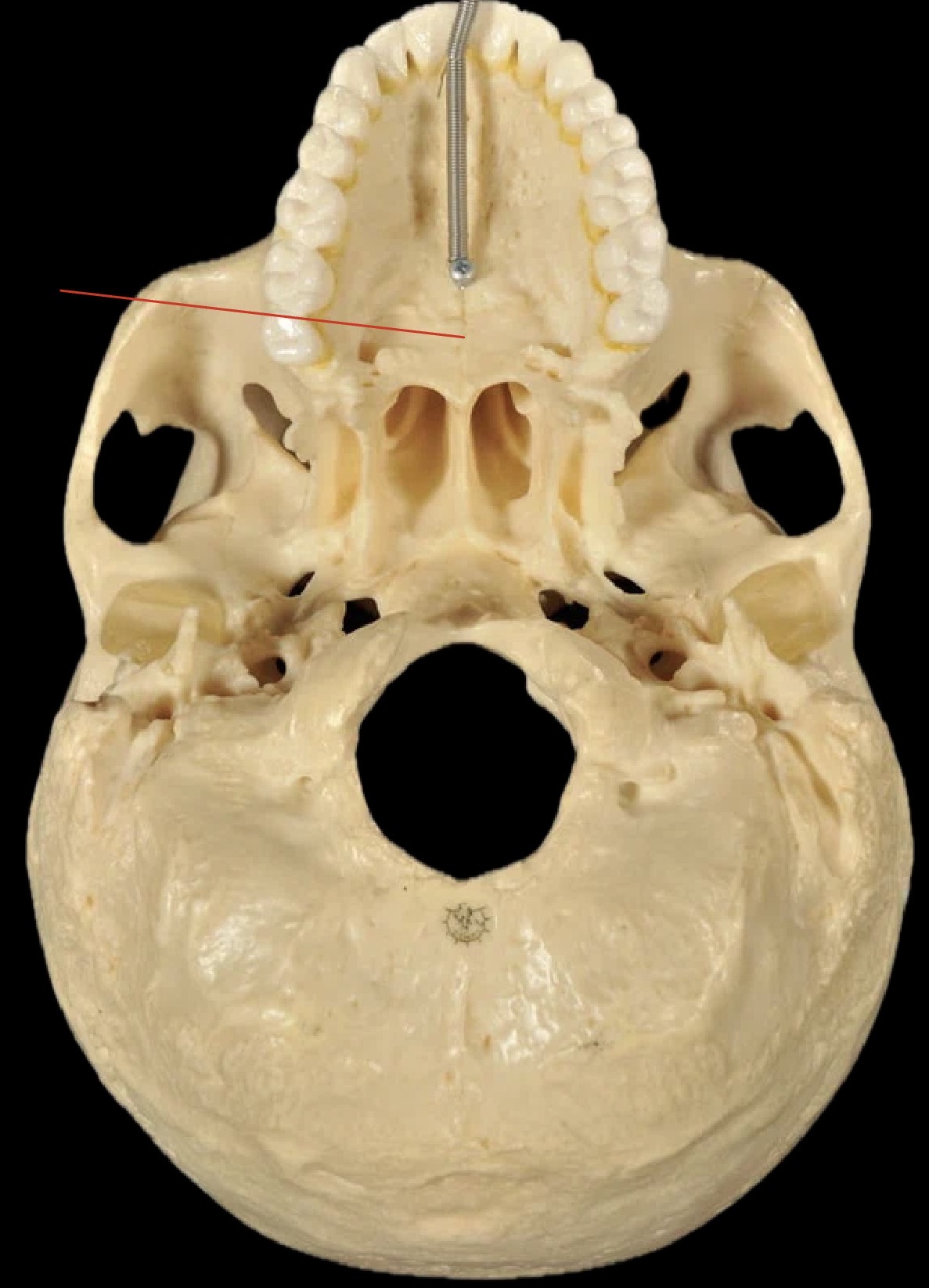 <p>What bones are these?</p>