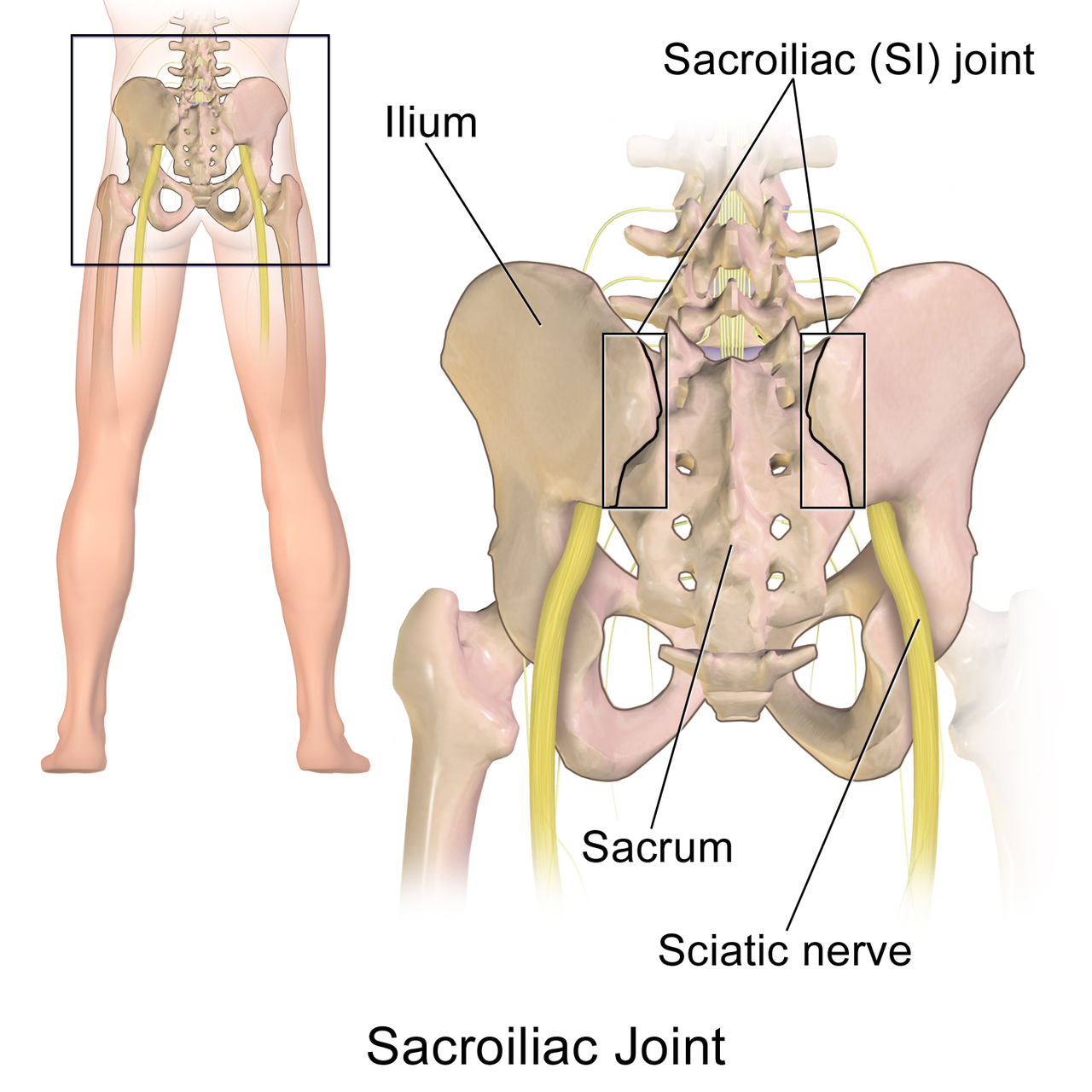 <p>Sacroiliac joint (SI) joint</p><p>Articulating bones - sacrum and articular/auricular surface on pelvis</p><p>Structural type - synovial; plane</p><p>Diarthrotic; slight gliding</p>