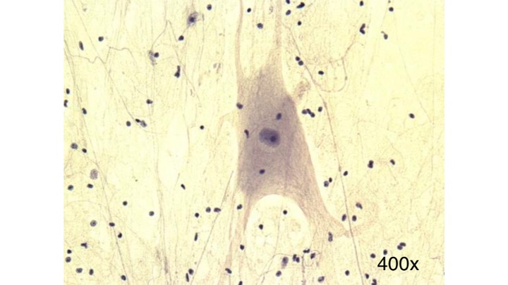 <p>Identify the type of tissue.</p>