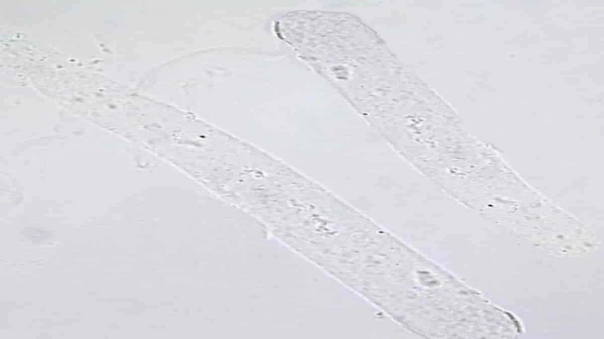<p>What kind of cast is this? Describe how it looks. What is the reference range? </p><p>Why may you see these in normal urine? If more than the normal reference range are seen, what diseases does it indicate? </p>