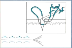 <p>What stich is this?</p>