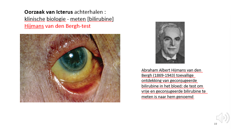 <p>Hijmans van den Bergh test</p><p></p>