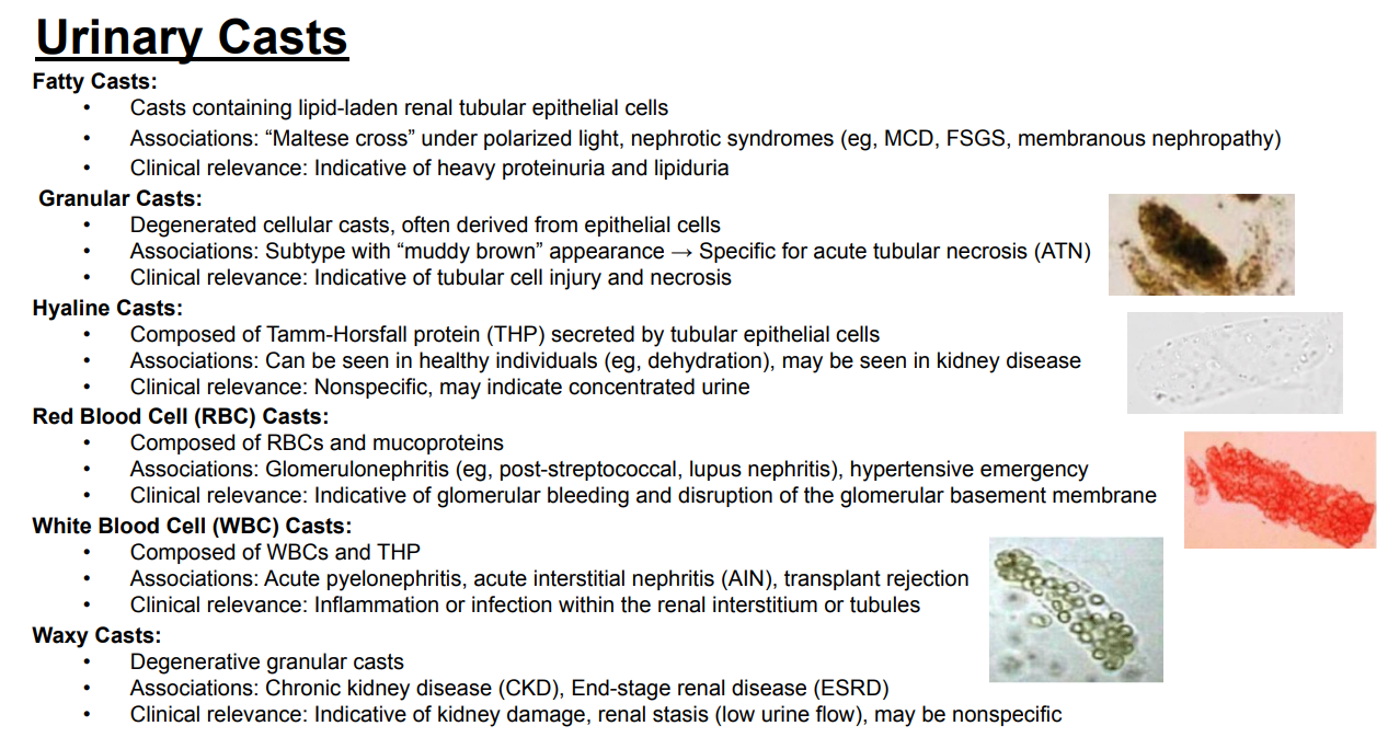 <p>Answer: Degenerative granular casts.</p><p>Extra Information:</p><ul><li><p>They are associated with advanced or chronic kidney disease on the slide.</p></li></ul><p></p>
