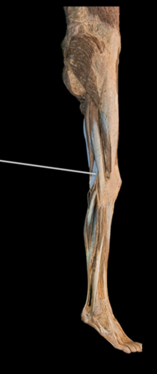 <p>What muscle is this?</p>