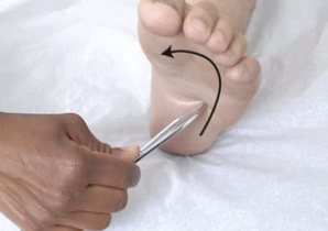 <p>Toes move downward</p>