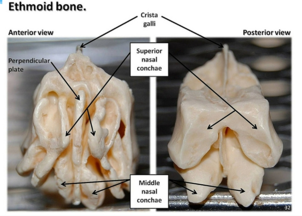 <p><strong>Perpendicular plate</strong></p><p>single plate that runs <strong>vertically down the middle</strong> of the bone</p>