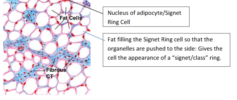 <p>Adipocyte</p>