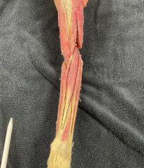 <p>Identify the muscle</p>