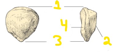<p><strong>On the image of this patella, what does number 1 represent?</strong></p>