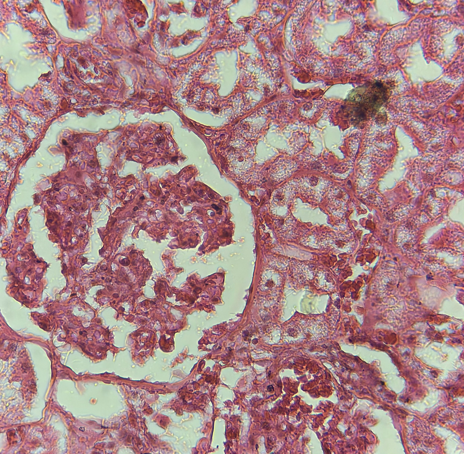 <p>diagnose</p>