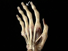 <p>In this anterior view of the right hand, identify the muscle responsible for the action indicated.</p>