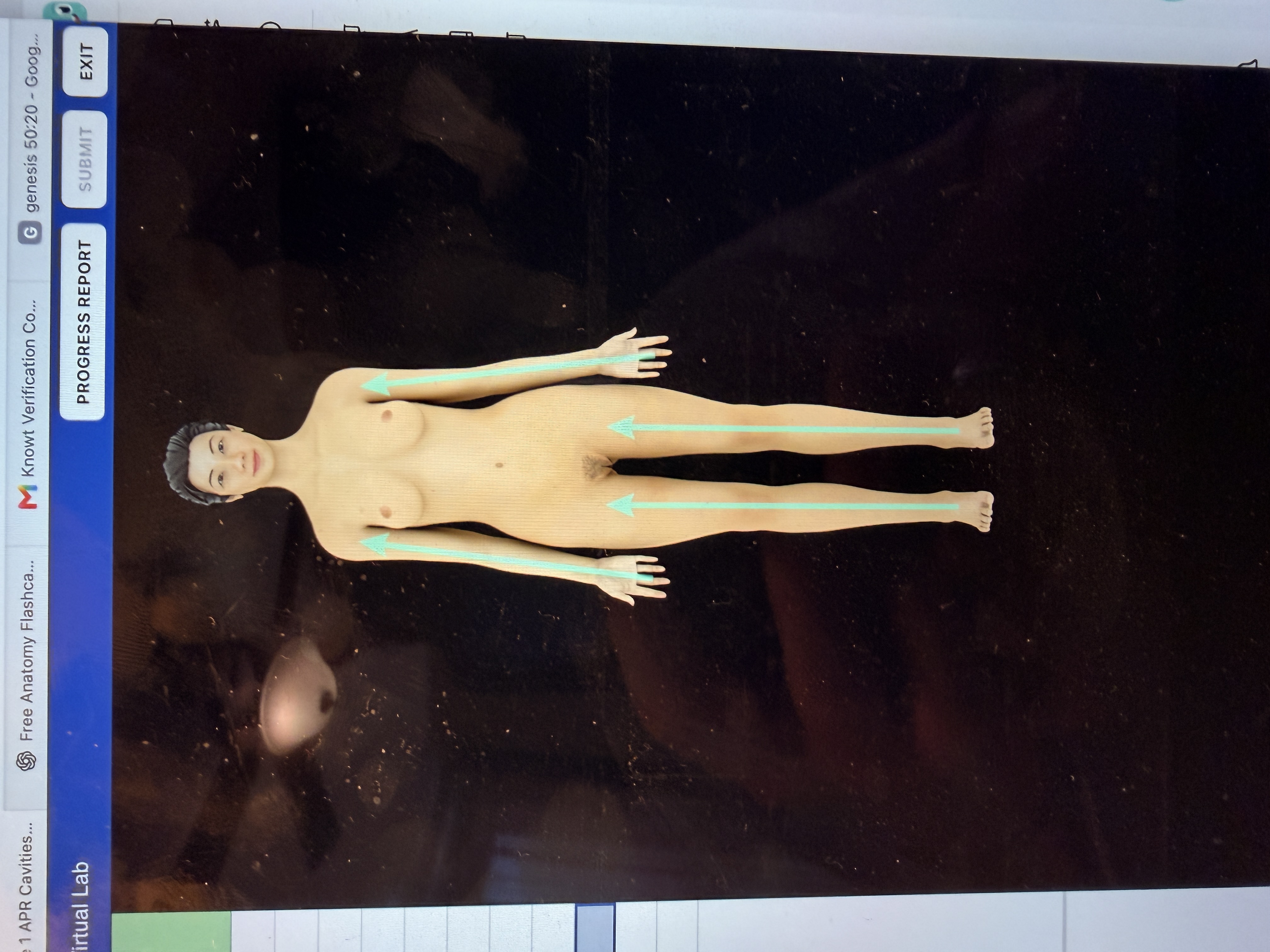 <p>What body orientation is this?</p>